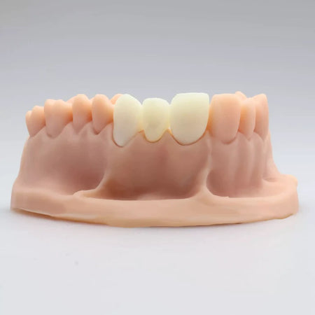 DentrealStore - Alias 3D Printer Resin for Dental Temp C&B - 1000 gr
