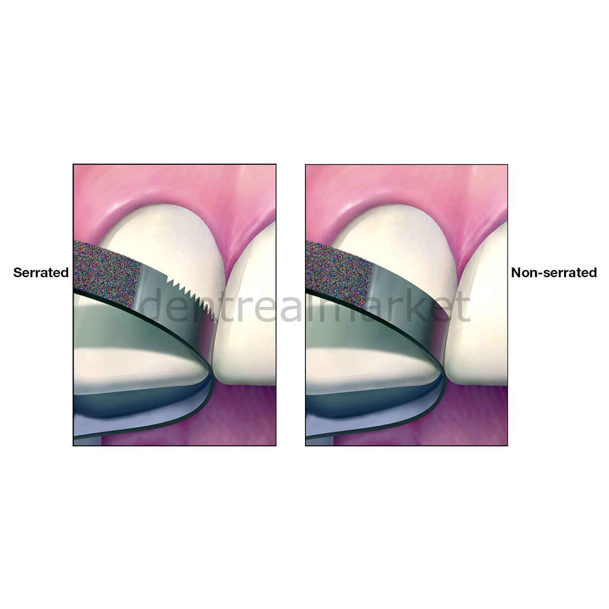 DentrealStore - Frank Dental Metal Interface Sanding Diamond Strip 3.75 mm